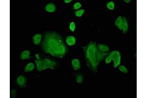 Immunofluorescence staining of MCF-7 cells with ABIN7176635 at 1:66, counter-stained with DAPI. (ZIC4 抗体  (AA 28-88))