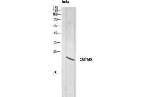 Western Blot (WB) analysis of HeLa lysis using CMTM8 antibody. (CMTM8 抗体)