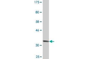 Western Blot detection against Immunogen (34. (RIMS2 抗体  (AA 181-260))
