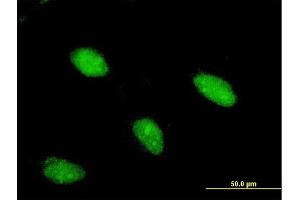 Immunofluorescence of monoclonal antibody to ARX on HeLa cell. (Arx 抗体  (AA 1-95))