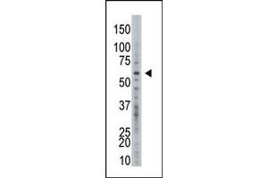 Image no. 1 for anti-Ubiquitin Specific Peptidase 21 (USP21) (C-Term) antibody (ABIN357556) (USP21 抗体  (C-Term))