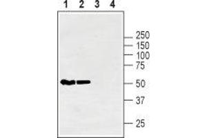 Western Blotting (WB) image for anti-Solute Carrier Family 2 (Facilitated Glucose Transporter), Member 1 (SLC2A1) (AA 468-481), (Intracellular) antibody (ABIN7043691)