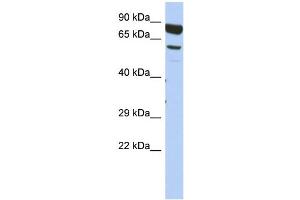 WB Suggested Anti-DPY19L4 Antibody Titration: 0. (DPY19L4 抗体  (Middle Region))