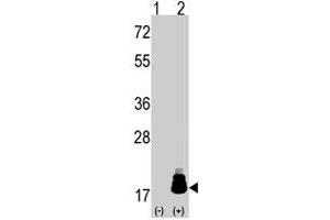 Western blot analysis of EIF4EBP1 (arrow) using rabbit EIF4EBP1 polyclonal antibody . (eIF4EBP1 抗体  (Thr69))