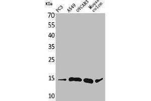 Western Blot analysis of PC-3 A549 OVCAR3 mouse colon cells using Eotaxin-3 Polyclonal Antibody (CCL26 抗体  (Internal Region))