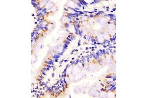 Immunohistochemistry (Paraffin-embedded Sections) (IHC (p)) image for anti-Lipoprotein-Associated phospholipase A2 (Lp-PLA2) (AA 200-228) antibody (ABIN653776)