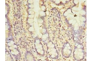 Immunohistochemistry of paraffin-embedded human small intestine tissue using ABIN7146141 at dilution of 1:100 (CXCL6 抗体  (AA 38-114))