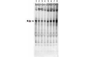 Affinity Purified Phospho-specific antibody to human muscle Glycogen Synthase (GS) at pS640 was used at a 1:1000 dilution to detect human muscle GS by Western blot. (Glycogen Synthase 1 抗体  (pSer640))