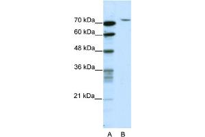 WB Suggested Anti-TAF6 Antibody Titration:  2. (TAF6 抗体  (N-Term))
