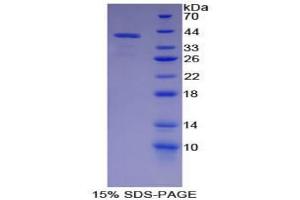SDS-PAGE analysis of Pig Parathyroid Hormone Protein. (PTH 蛋白)