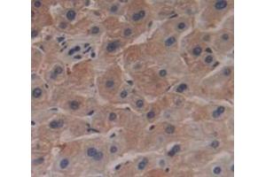 Used in DAB staining on fromalin fixed paraffin- embedded Kidney tissue (RNASE9 抗体  (AA 28-210))