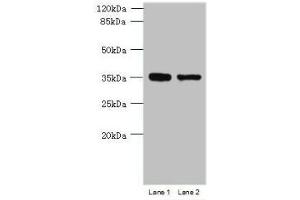 Western blot All lanes: MGME1 antibody at 1 μg/mL Lane 1: Jurkat whole cell lysate Lane 2: 293T whole cell lysate Secondary Goat polyclonal to rabbit IgG at 1/10000 dilution Predicted band size: 39 kDa Observed band size: 39 kDa (C20orf72 抗体  (AA 81-260))