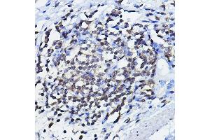 Immunohistochemistry of paraffin-embedded human lymph node using TP73 Rabbit pAb (ABIN6133470, ABIN6149430, ABIN6149431 and ABIN6213831) at dilution of 1:100 (40x lens). (Tumor Protein p73 抗体  (AA 1-100))