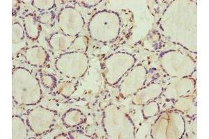 Immunohistochemistry of paraffin-embedded human thyroid tissue using ABIN7168238 at dilution of 1:100 (RNF11 抗体  (AA 1-154))