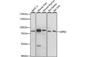 Western blot analysis of extracts of various cell lines, using CEP63 antibody (ABIN7266278) at 1:1000 dilution. (CEP63 抗体  (AA 1-300))