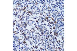 Immunohistochemistry of paraffin-embedded human tonsil using UHRF1 antibody (ABIN5971303) at dilution of 1/100 (40x lens). (UHRF1 抗体)