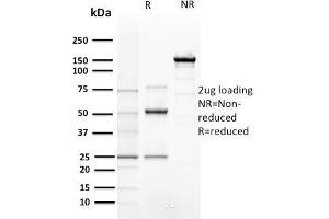 SDS-PAGE Analysis of Purified Cyclin E1 Mouse Recombinant Monoclonal Antibody ABIN6383795. (Cyclin E1 抗体  (AA 10-176))