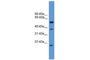 WB Suggested Anti-SPINT2 Antibody Titration: 0. (SPINT2 抗体  (Middle Region))