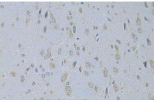 Immunohistochemistry of paraffin-embedded Rat brain using IGF2 Polyclonal Antibody at dilution of 1:100 (40x lens). (IGF2 抗体)