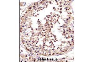 Immunohistochemistry (Formalin/PFA-fixed paraffin-embedded sections) of human testis tissue with LOC728137 polyclonal antibody  followed by peroxidase conjugation of the secondary antibody and DAB staining. (TSPY3 抗体  (AA 274-303))