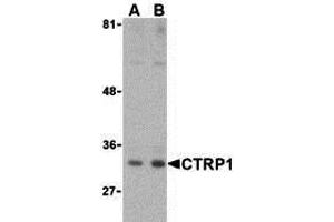 Western Blotting (WB) image for anti-C1q and Tumor Necrosis Factor Related Protein 1 (C1QTNF1) (Middle Region) antibody (ABIN1030910) (C1QTNF1 抗体  (Middle Region))