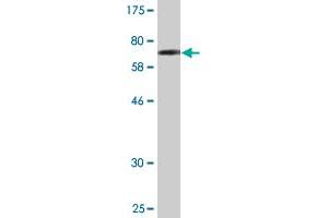 Western Blot detection against Immunogen (66 KDa) . (TARBP2 抗体  (AA 1-366))