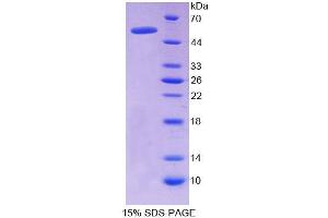 SDS-PAGE analysis of Rat FXR Protein.