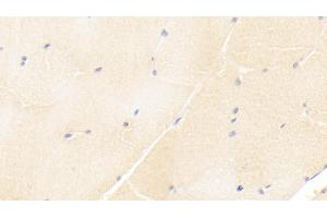 Detection of ISLR in Human Skeletal muscle Tissue using Monoclonal Antibody to Immunoglobulin Superfamily Containing Leucine Rich Repeat Protein (ISLR) (ISLR 抗体  (AA 19-428))