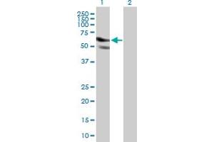 Western Blot analysis of GPATCH2 expression in transfected 293T cell line by GPATCH2 MaxPab polyclonal antibody. (GPATCH2 抗体  (AA 1-376))