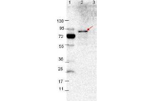 Western blot showing detection of 0. (VlsE 抗体)