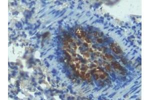 Immunohistochemistry (IHC) image for anti-Angiopoietin 2 (ANGPT2) (AA 19-147) antibody (ABIN7430336)