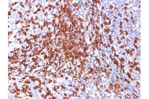 Immunohistochemistry (IHC) image for anti-CD44 (CD44) antibody (ABIN6941197)