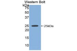 Western blot analysis of the recombinant protein. (SPRY2 抗体  (AA 116-304))