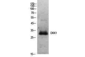 Western Blotting (WB) image for anti-Dickkopf Homolog 1 (DKK1) (Internal Region) antibody (ABIN3178908) (DKK1 抗体  (Internal Region))