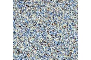 IHC analysis of PPA2 using anti-PPA2 antibody (ABIN6719431). (PPA2 抗体  (AA 33-334))