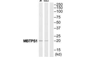 Western blot analysis of extracts from Jurkat/COLO205 cells, using MBTPS1 antibody. (MBTPS1 抗体  (C-Term))