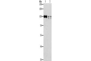 Gel: 8 % SDS-PAGE, Lysate: 40 μg, Lane 1-2: K562 cells, Jurkat cells, Primary antibody: ABIN7128244(ADAMTSL2 Antibody) at dilution 1/350, Secondary antibody: Goat anti rabbit IgG at 1/8000 dilution, Exposure time: 5 minutes (ADAMTSL2 抗体)