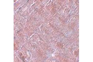 Immunohistochemistry (IHC) image for anti-RAN Binding Protein 10 (RANBP10) (Middle Region) antibody (ABIN1031052) (RANBP10 抗体  (Middle Region))