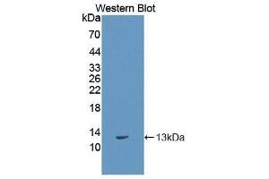 Western Blotting (WB) image for anti-S100 Calcium Binding Protein A11 (S100A11) antibody (Biotin) (ABIN1173190) (S100A11 抗体  (Biotin))