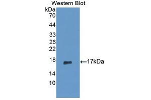 Detection of Recombinant PIP, Human using Polyclonal Antibody to Prolactin Induced Protein (PIP) (PIP 抗体  (AA 41-139))
