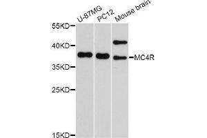 Western blot analysis of extracts of various cell lines, using MC4R Antibody (ABIN5998196) at 1/1000 dilution. (MC4R 抗体)