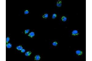 IF analysis of Giantin/GOLGB1 using anti-Giantin/GOLGB1 antibody (ABIN7600139).