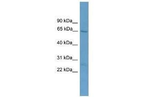 ACOT11 antibody used at 1 ug/ml to detect target protein. (ACOT11 抗体  (Middle Region))