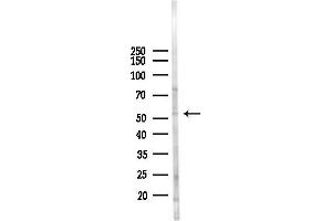 anti-F-Box and Leucine-Rich Repeat Protein 7 (FBXL7) antibody