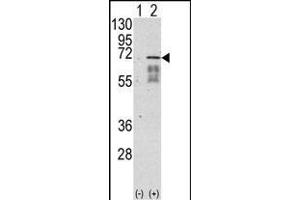 Western blot analysis of ACVR1 (arrow) using rabbit polyclonal ACVR1 Antibody (Center ) (ABIN391154 and ABIN2841264).