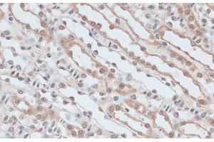 Immunohistochemistry of paraffin-embedded Mouse kidney using ZNF581 Polyclonal Antibody at dilution of 1:100 (40x lens). (ZNF581 抗体)