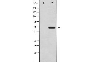 Western blot analysis of Vitamin D Receptor expression in Jurkat whole cell lysates,The lane on the left is treated with the antigen-specific peptide. (Vitamin D Receptor 抗体  (Internal Region))