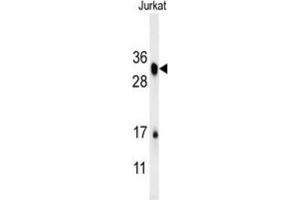 Western Blotting (WB) image for anti-R-Spondin 4 (RSPO4) antibody (ABIN3002419)