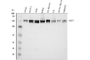 Western blot analysis of RAD50 using anti-RAD50 antibody (ABIN7599857).