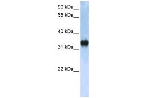 WB Suggested Anti-ZCCHC17 Antibody Titration:  0. (ZCCHC17 抗体  (C-Term))
